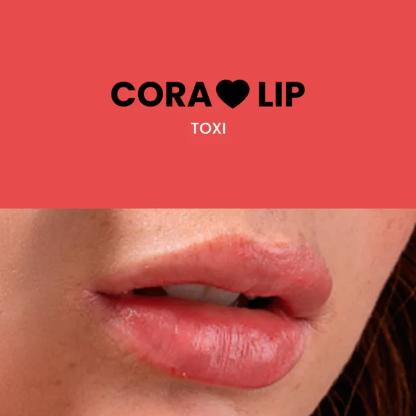 Cora Lip Montoc - Image 8